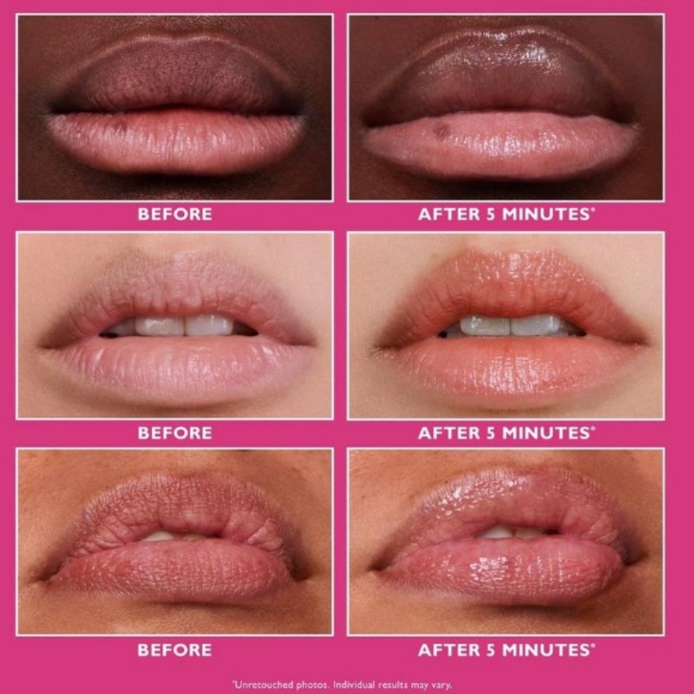 Peter Thomas Roth Instant FIRMX Lip Filler - Picture 5 of 7